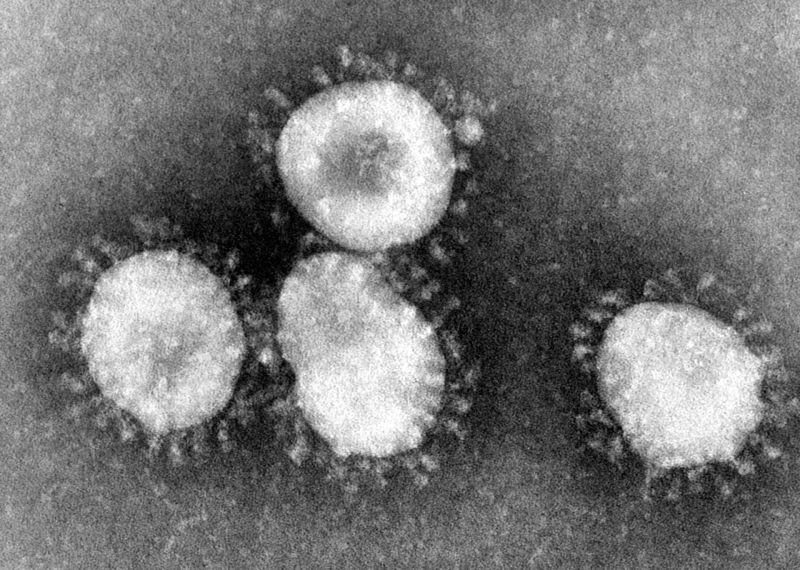Coronavirusurile văzute la microscopul electronic cu spicule pe învelişul extern cu aspect de coroană solară - foto preluat de pe ro.wikipedia.org